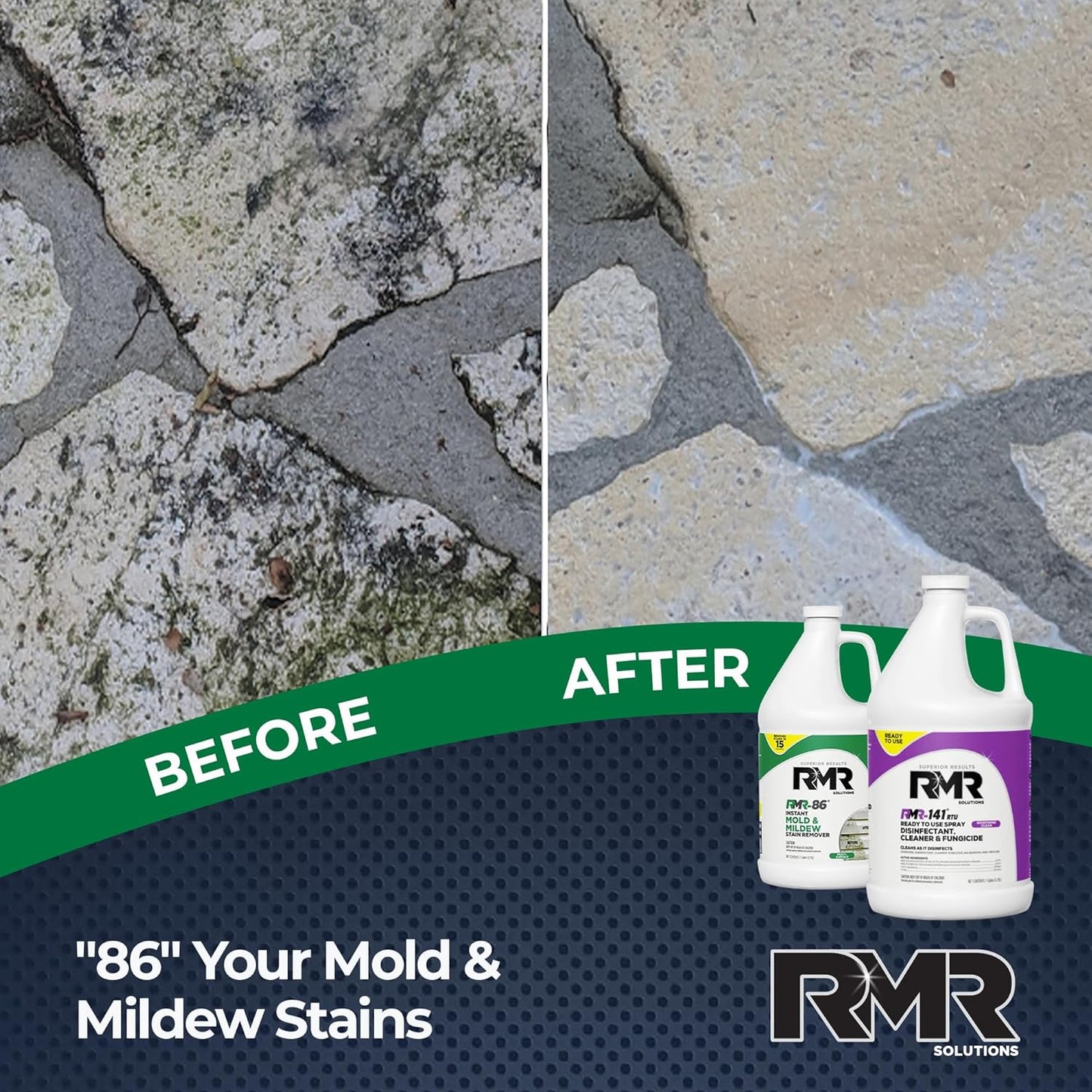 RMR Brands DIY Mold Remover Bundle - Complete Mold Killer & Stain Remover Bundle - Mold and Mildew