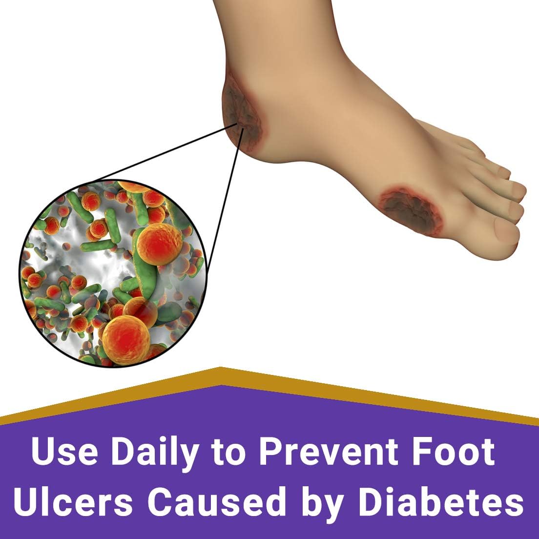 SkinSmart Daily Foot Cleanser for At-Risk Feet, Removes Bacteria to Help Avoid Infections, 8 ounce