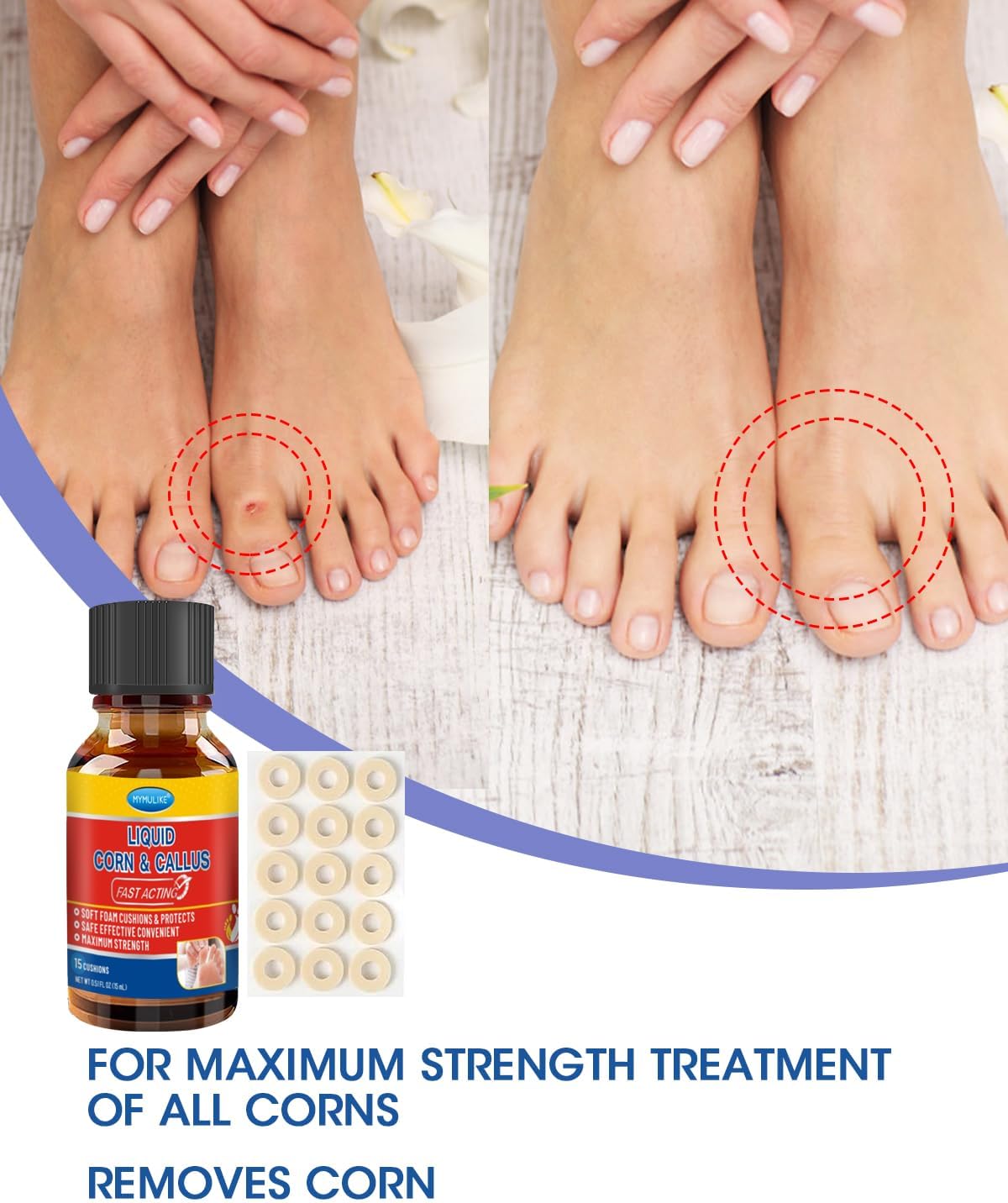 Liquid Corn Remover, Corn Removers for Toes, Fast Acting, Safe Removes Corns Fast Extra Strength