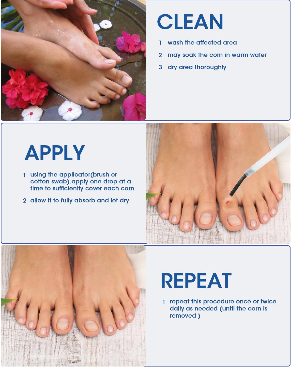 Liquid Corn Remover, Corn Removers for Toes, Fast Acting, Safe Removes Corns Fast Extra Strength