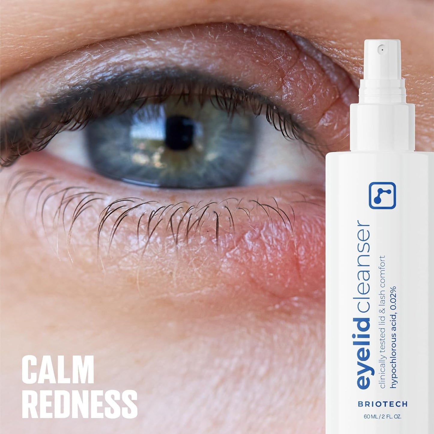 BRIOTECH Eyelid Cleanser, Hypochlorous Acid Spray, Lid & Eyelash Cleanser, Soothe Sensitivities