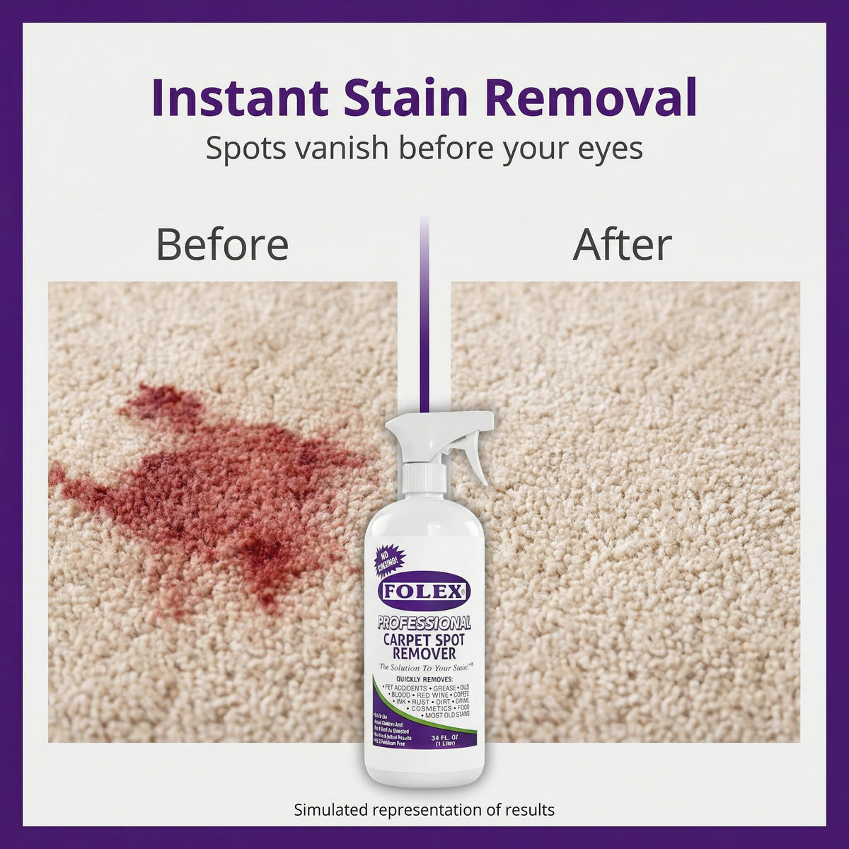 FOLEX - Professional Carpet Cleaner Spray 34 oz - Pet Stain Removal - Instant Stain Removal - No